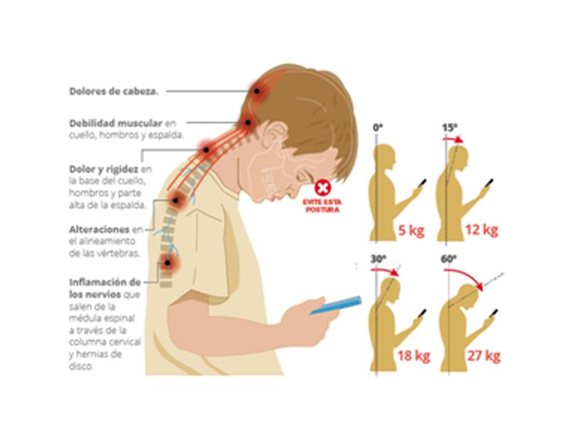 text neck-fisio lobera